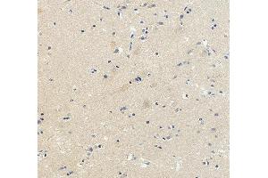 IHC analysis of DCC using anti-DCC antibody (ABIN7602566).