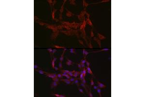 Immunofluorescence analysis of PC-12 cells using GSDMD (Full Length+C terminal) Rabbit pAb (ABIN7267350) at dilution of 1:250 (40x lens). (GSDMD anticorps  (AA 276-484))