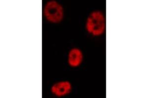 ABIN6267601 staining HeLa by IF/ICC.