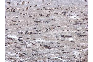 IHC-P Image HUS1 antibody detects HUS1 protein at cytosol and nucleus on rat fore brain by immunohistochemical analysis.