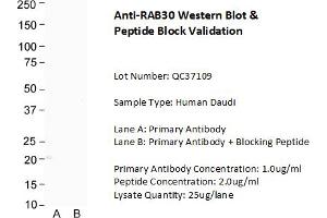 Host: Rabbit Target Name: RAB30 Sample Type: Human Daudi Lane A: Primary Antibody  Lane B: Primary Antibody + Blocking Peptide  Primary Antibody Concentration: 1.