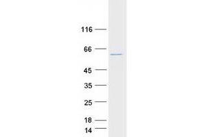 Validation with Western Blot