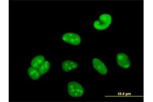 Immunofluorescence of purified MaxPab antibody to WBSCR22 on HeLa cell. (WBSCR22 anticorps  (AA 1-281))