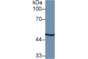 Detection of PSMC2 in Mouse Liver lysate using Polyclonal Antibody to Proteasome 26S Subunit, ATPase 2 (PSMC2)