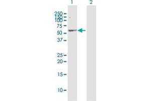 Western Blot analysis of SERPINA1 expression in transfected 293T cell line by SERPINA1 MaxPab polyclonal antibody.