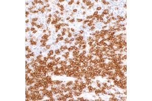 Immunohistochemistry (IHC) image for anti-CD3 epsilon (CD3E) (AA 157-207) antibody (ABIN7454035) (Recombinant CD3 epsilon anticorps  (AA 157-207))
