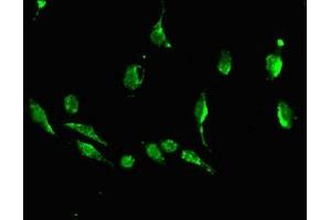 Immunofluorescent analysis of U251 cells using ABIN7149878 at dilution of 1:100 and Alexa Fluor 488-congugated AffiniPure Goat Anti-Rabbit IgG(H+L)
