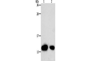 Western Blot analysis of Hela cell and Human liver cancer tissue using TXN Polyclonal Antibody at dilution of 1:700 (TXN anticorps)