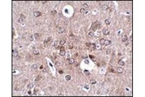 anti-Protocadherin 18 (PCDH18) (N-Term) antibody