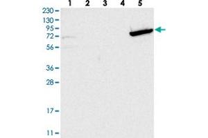 Western blot analysis of Lane 1: RT-4, Lane 2: U-251 MG, Lane 3: Human Plasma, Lane 4: Liver, Lane 5: Tonsil with GBP6 polyclonal antibody . (GBP6 anticorps)