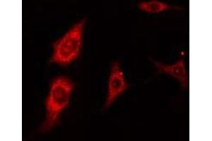 ABIN6277410 staining LOVO cells by IF/ICC.