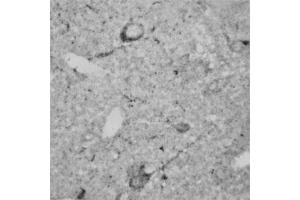 IHC on rat brain (paraffin sections) using Rabbit antibody to RhoA   at a concentration of 15 µg/ml, incubated overnight and developed with DAB Ni. (RHOA anticorps  (AA 100-150))