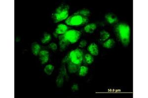 Image no. 2 for anti-Interferon Regulatory Factor 5 (IRF5) antibody (ABIN6745988) (IRF5 anticorps)