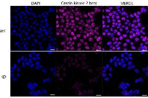 anti-Casein Kinase 2, beta (CSNK2B) antibody