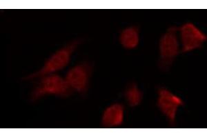 ABIN6269342 staining HT29 by IF/ICC. (PRKAA1 anticorps  (C-Term))