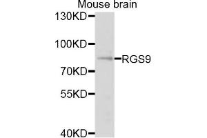 Western blot analysis of extracts of mouse brain cells, using RGS9 antibody. (RGS anticorps)