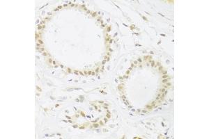 Immunohistochemistry of paraffin-embedded human breast using RBPJ Antibody (ABIN1876876) at dilution of 1:100 (40x lens). (RBPJ anticorps)