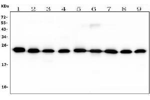 Western blot analysis of RAB11B using anti-RAB11B antibody (ABIN7602766). (RAB11B anticorps  (C-Term))
