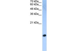 WB Suggested Anti-HIST2H2AC Antibody Titration:  2. (HIST2H2AC anticorps  (Middle Region))