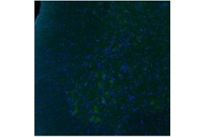 Immunofluorescence-- 1.