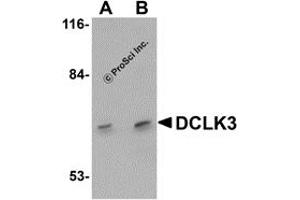 Western Blotting (WB) image for anti-Doublecortin-Like Kinase 3 (DCLK3) (N-Term) antibody (ABIN1031346) (DCLK3 anticorps  (N-Term))