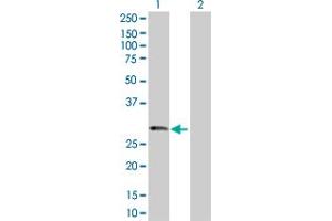 Western Blot analysis of PRSS1 expression in transfected 293T cell line by PRSS1 MaxPab polyclonal antibody. (PRSS1 anticorps  (AA 1-247))