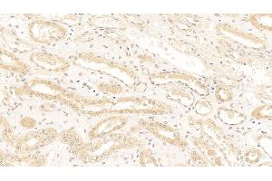 Detection of TDP43 in Human Kidney Tissue using Polyclonal Antibody to Tar DNA Binding Protein 43 kDa (TDP43)