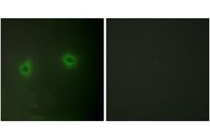 Immunofluorescence analysis of HeLa cells, using Caper Antibody.