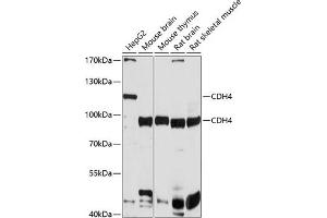 Western blot analysis of extracts of various cell lines, using CDH4 antibody (ABIN6129232, ABIN6138295, ABIN6138296 and ABIN6214850) at 1:1000 dilution. (Cadherin 4 anticorps  (AA 757-916))