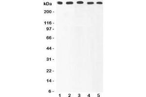 Western blot testing of Ki67 antibody and Lane 1:  HeLa;  2: MCF-7;  3: COLO320;  4: HEPG2;  5: SKOV lysate. (Ki-67 anticorps  (AA 2860-3256))