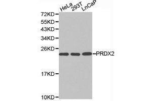 Western Blotting (WB) image for anti-Peroxiredoxin 2 (PRDX2) antibody (ABIN1874253) (Peroxiredoxin 2 anticorps)