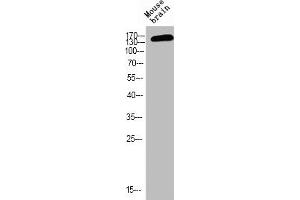 Western blot analysis of MOUSE-BRAIN using p-NMDAε2 (Y1474) antibody. (GRIN2B anticorps  (pTyr1474))