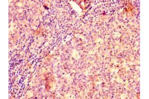 IHC image of ABIN7145433 diluted at 1:500 and staining in paraffin-embedded human tonsil tissue performed on a Leica BondTM system. (GRK2 anticorps  (AA 2-221))