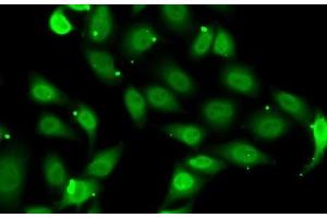 Immunofluorescence analysis of MCF7 cells using TEAD1 Polyclonal Antibody (TEAD1 anticorps)