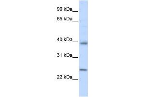 WB Suggested Anti-CLDN7 Antibody Titration: 0. (Claudin 7 anticorps  (C-Term))