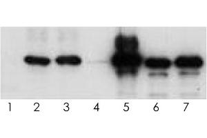 Western blot analysis of human tau (2N4R) using various antisera. (tau anticorps  (Isoform 6, pTyr18))