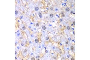 Immunohistochemistry of paraffin-embedded human liver injury using FAH antibody.