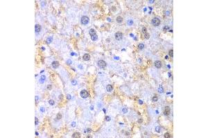 Immunohistochemistry of paraffin-embedded human liver injury using FAH antibody. (FAH anticorps  (AA 1-419))