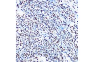 Immunohistochemistry of paraffin-embedded human lymph node using S Rabbit pAb (ABIN6128698, ABIN6147392, ABIN6147393 and ABIN6215703) at dilution of 1:100 (40x lens).
