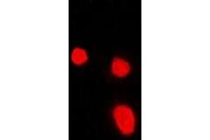 Immunofluorescent analysis of Malin staining in Hela cells. (NHLRC1 anticorps)