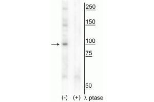 Western blot of human T47D cell lysate showing specific immunolabeling of the ~100 kDa CtIP phosphorylated at Thr847 in the first lane (-). (Retinoblastoma Binding Protein 8 anticorps  (pThr847))