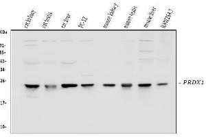 Western blot analysis of Peroxiredoxin 1 using anti-Peroxiredoxin 1 antibody (ABIN3043903). (Peroxiredoxin 1 anticorps  (Middle Region))