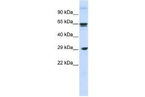 Western Blotting (WB) image for anti-C-Type Lectin Domain Family 4, Member M (CLEC4M) antibody (ABIN2458650) (C-Type Lectin Domain Family 4, Member M (CLEC4M) anticorps)
