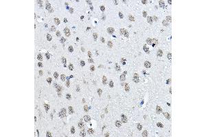 Immunohistochemistry of paraffin-embedded mouse brain using MonoMethyl-Histone H3-K27 Rabbit pAb (ABIN3023262, ABIN3023263, ABIN3023264, ABIN1513004 and ABIN6219518) at dilution of 1:100 (40x lens). (Histone 3 anticorps  (H3K27me1))