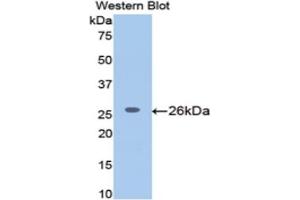 Western blot analysis of the recombinant protein. (MGEA5 anticorps  (AA 19-222))