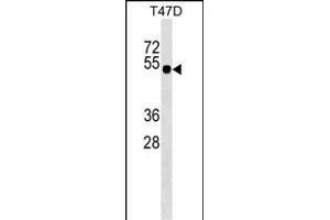 GLI4 Antibody (N-term) (ABIN1539446 and ABIN2849209) western blot analysis in T47D cell line lysates (35 μg/lane). (GLI4 anticorps  (N-Term))