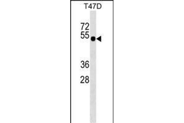 GLI4 anticorps  (N-Term)