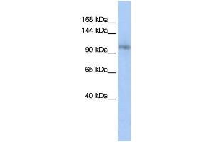 WB Suggested Anti-TCERG1 Antibody Titration:  0. (TCERG1 anticorps  (Middle Region))