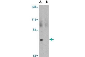 Western blot analysis of JPH2 in 293 cell lysate with JPH2 polyclonal antibody  at 2 ug/mL in (A) the absence and (B) the presence of blocking peptide. (Junctophilin 2 anticorps  (C-Term))