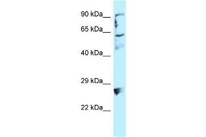 WB Suggested Anti-LIMA1 Antibody Titration: 1. (LIMA1 anticorps  (C-Term))